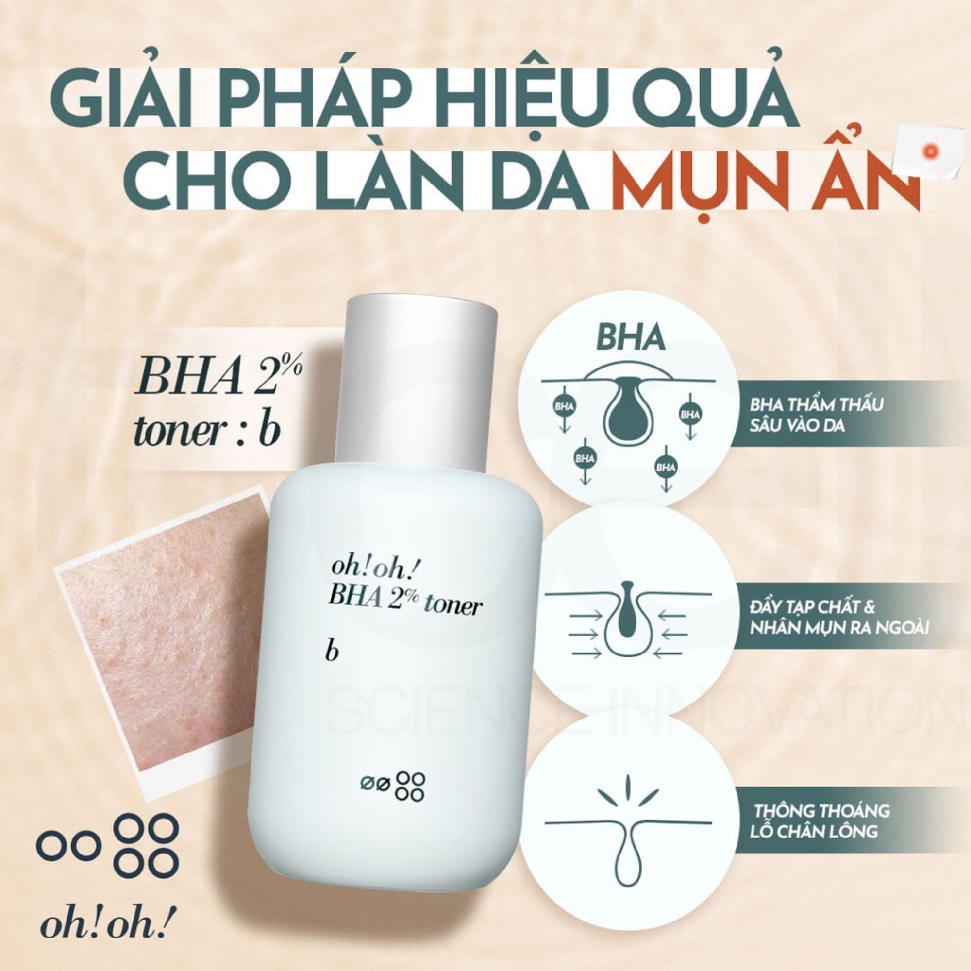 Nước cân bằng tẩy tế bào chết, làm sạch sâu da oh!oh! BHA 2% toner : b - 75ml
