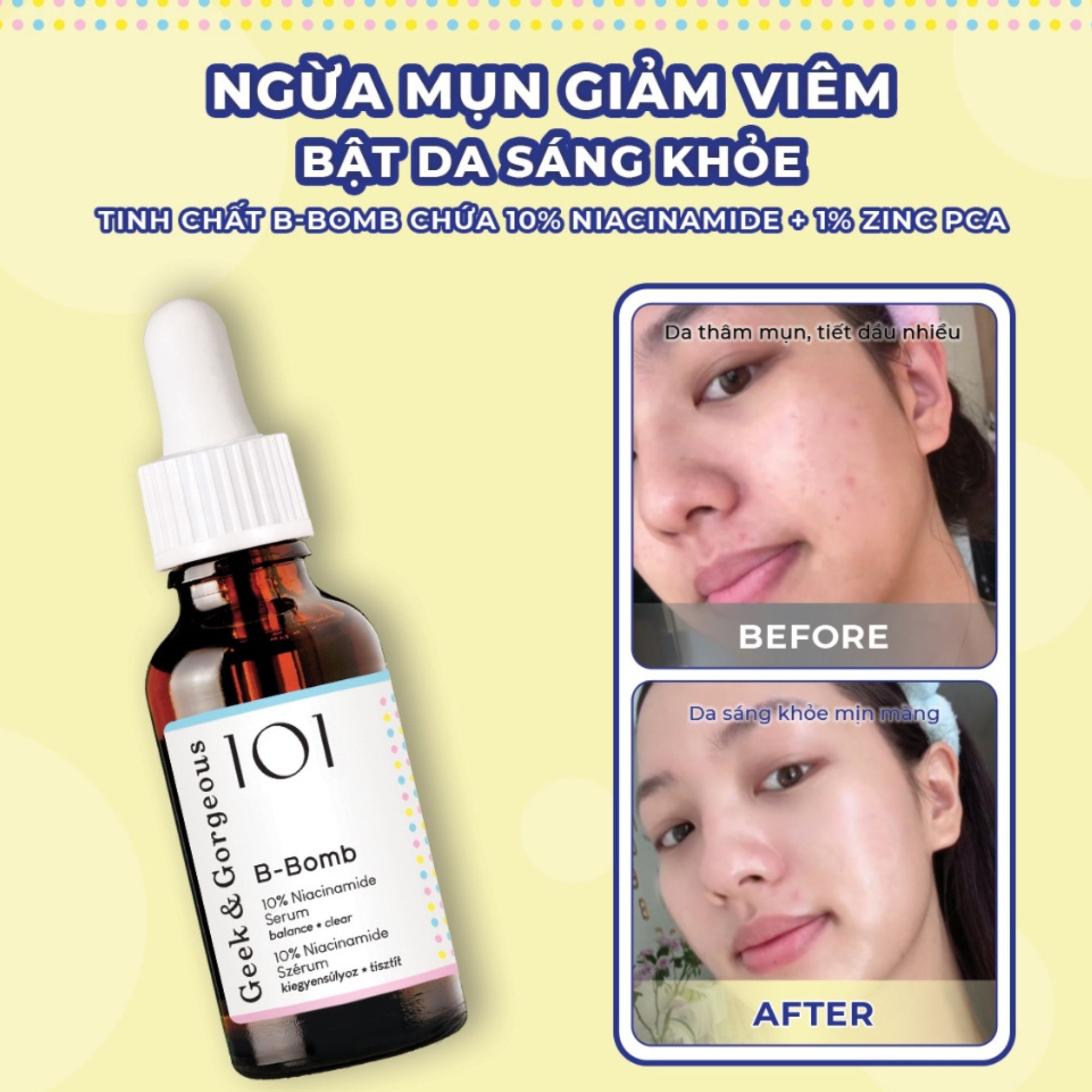 Tinh chất kiềm dầu, hỗ trợ kháng viêm, cải thiện mụn Geek&Gorgeous B-Bomb - 30ml