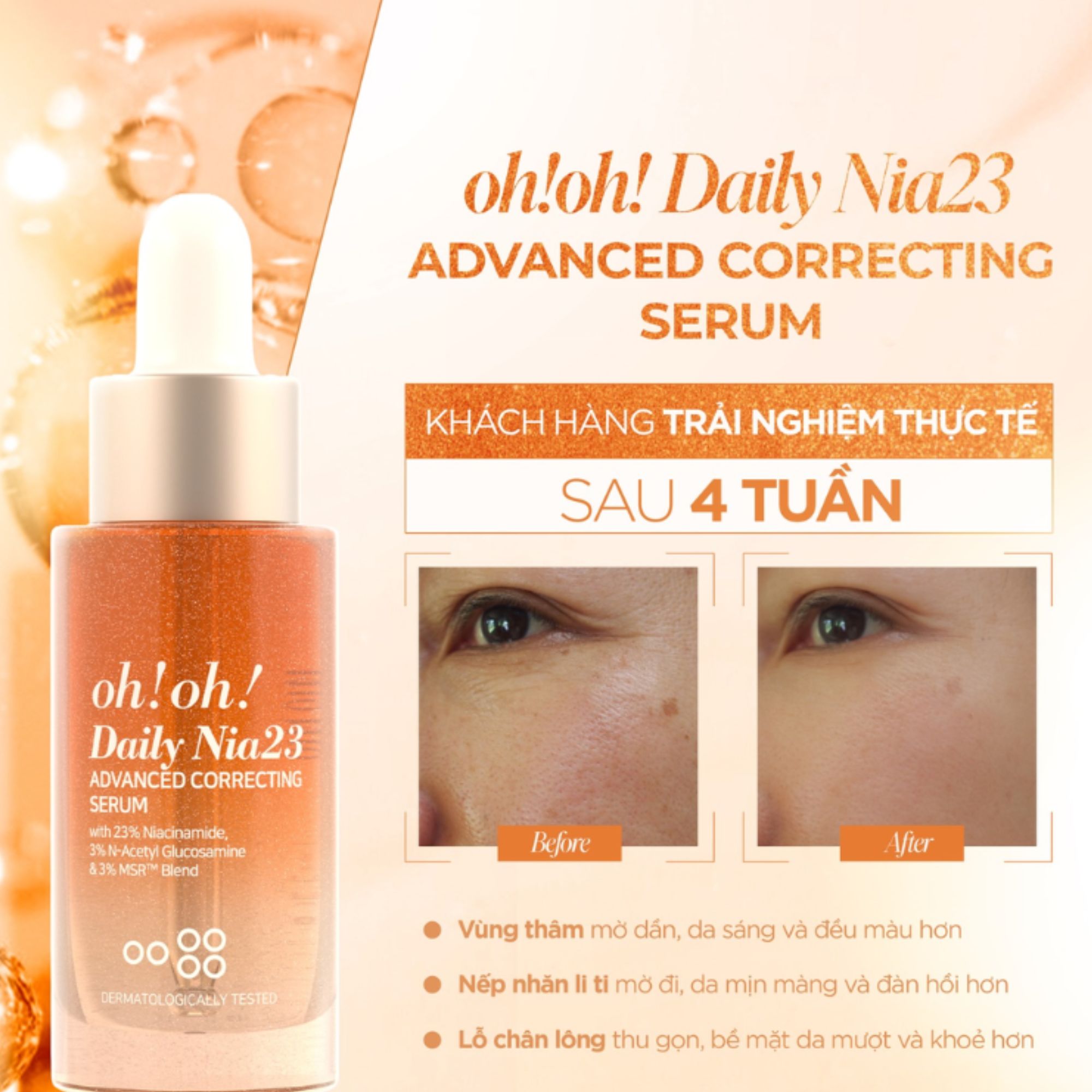Tinh chất sửa chữa sắc tố chuyên sâu, sáng da & giảm thâm nám oh!oh -30ml