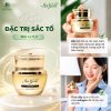 Kem đặc trị sắc tố Iris Gold - 30g
