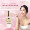 Tinh chất mụn Iris Gold - 30ml